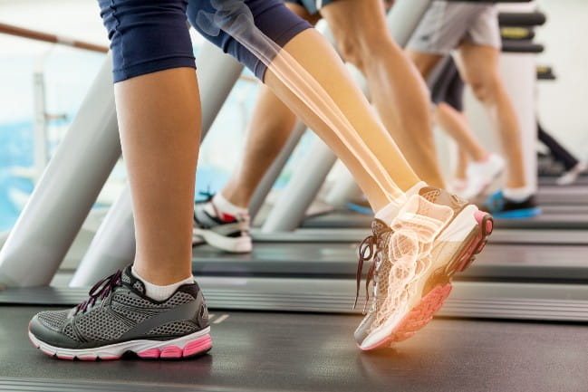 Person on treadmill. Their right calf is overlayed with an illustration of the bone inside.