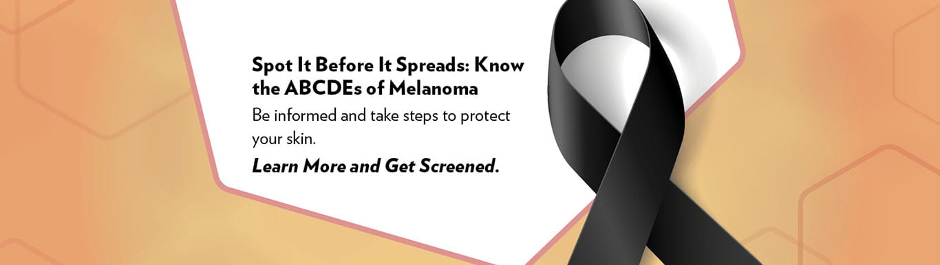 black melanoma awareness ribbon with text that says spot it before it spreads: know the ABCDEs of melanoma. Be informed and take steps to protect your skin. Learn more and get screened